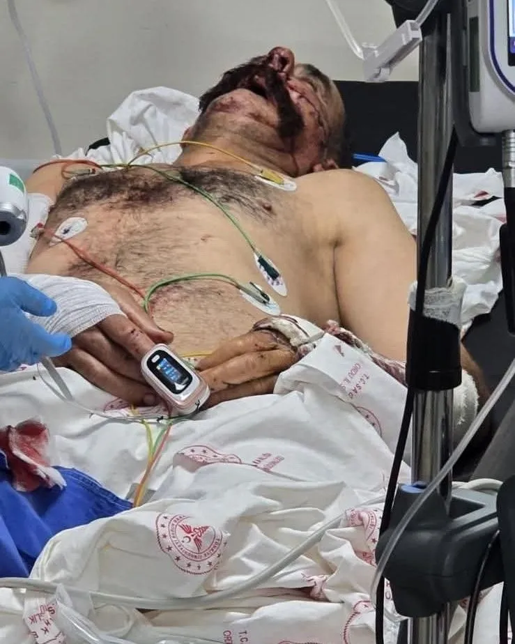 Ordu’da Fındık Bahçesinde Dehşet